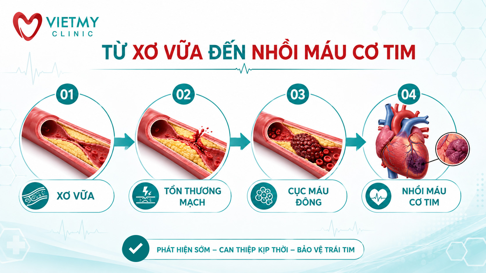 tu-xo-vua-den-nhoi-mau-co-tim-viet-my-clinic-vmc